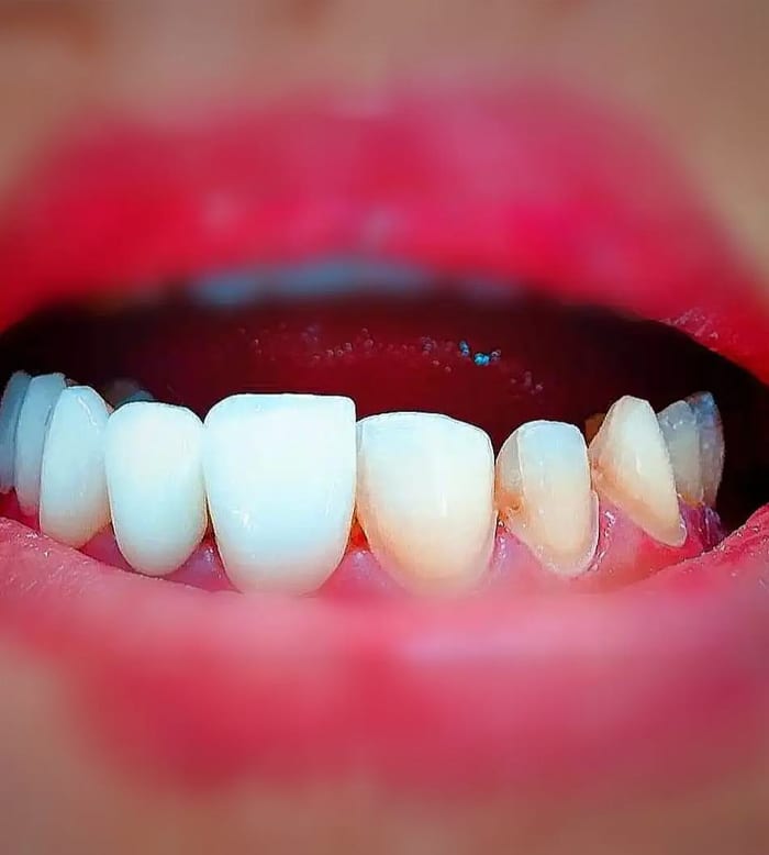 Dental Construction
