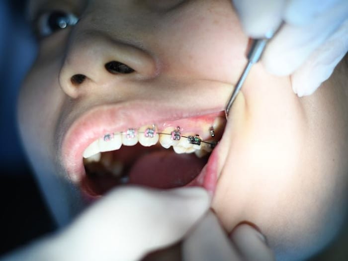 Orthodontics
